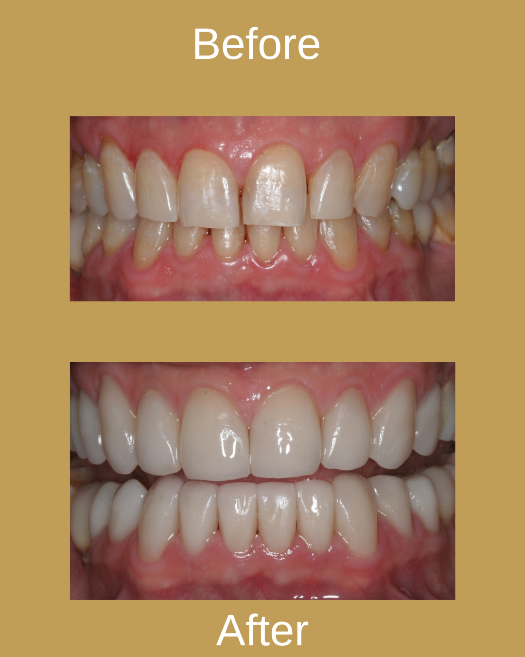 Dental Result 9