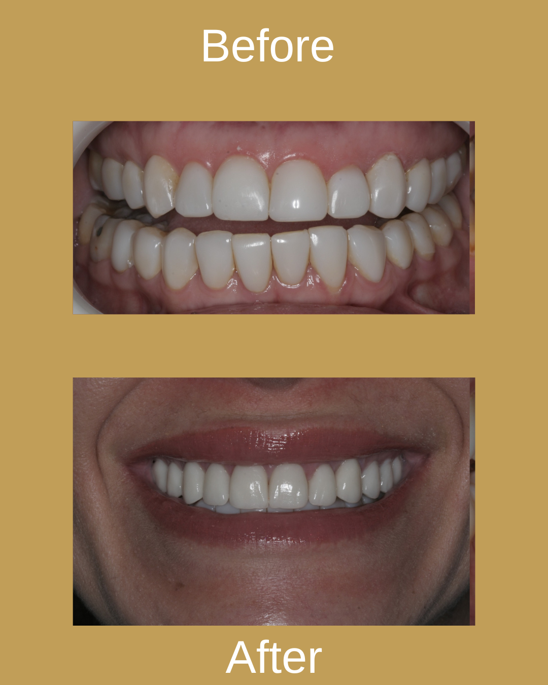 Dental Result 8