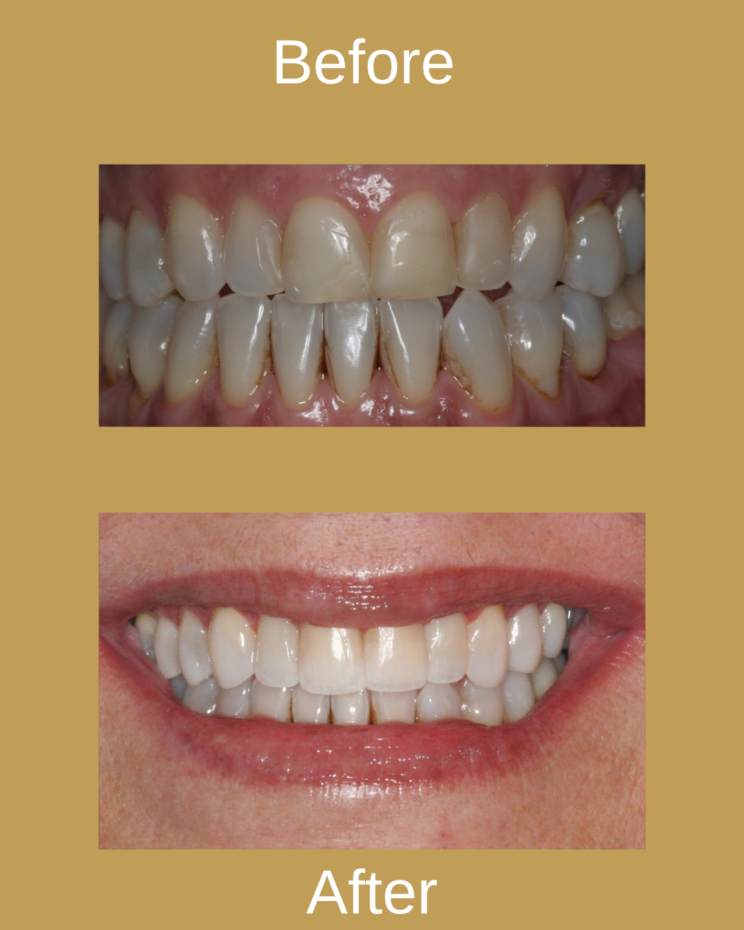Dental Result 7