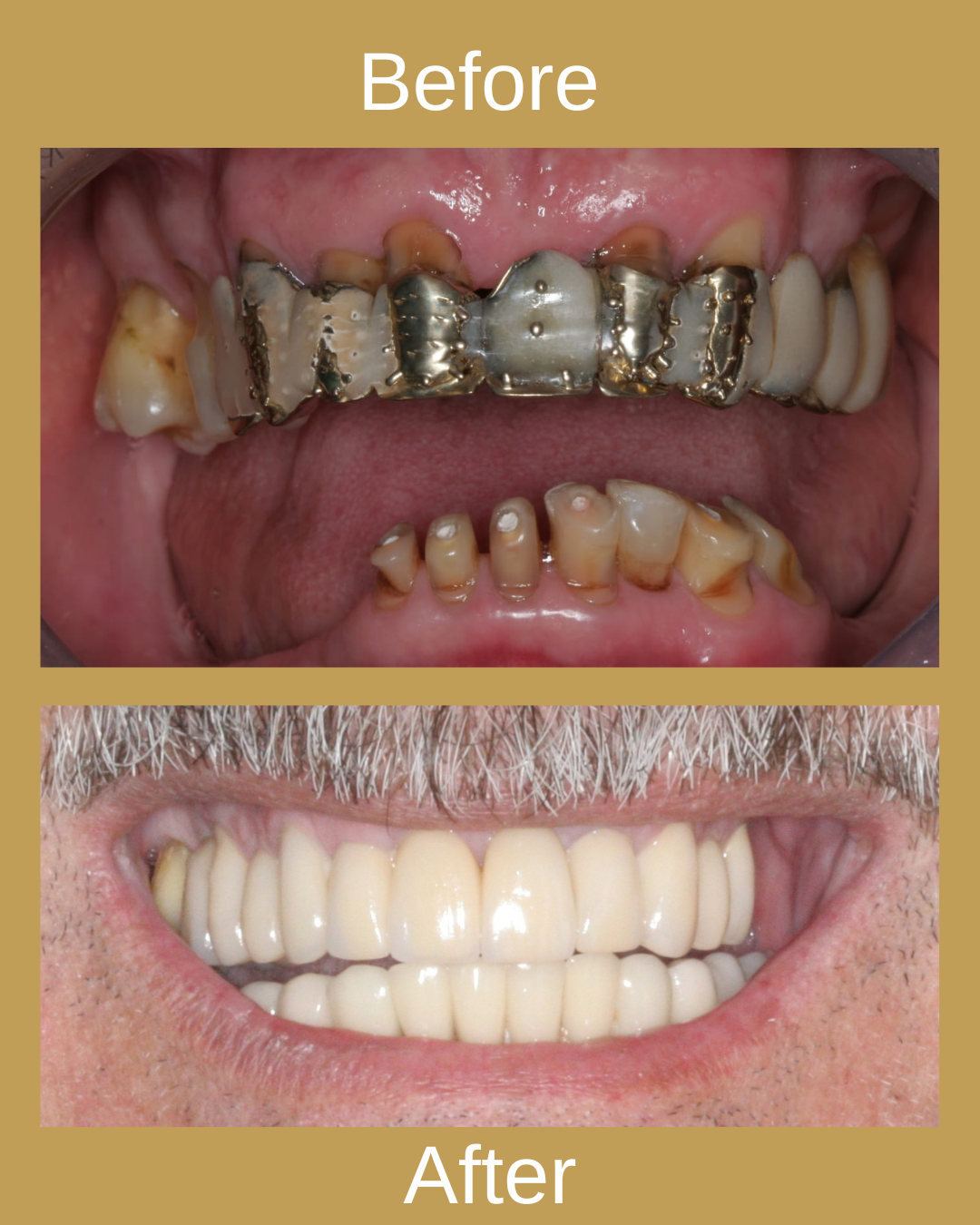 Dental Result 10