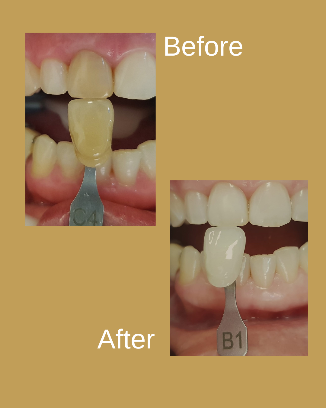 Dental Result 11