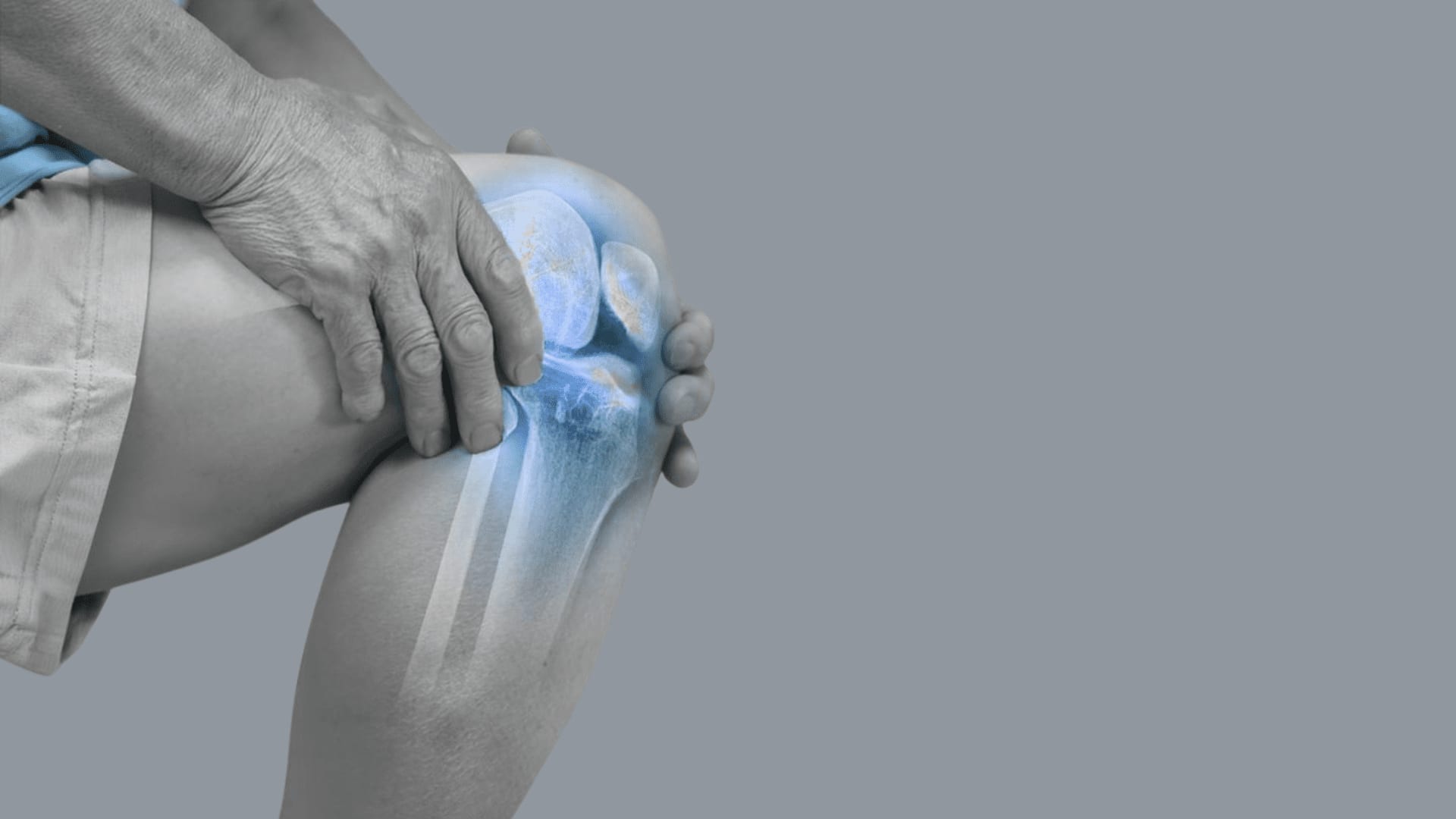 Rheumatoid Arthritis After Hysterectomy Rheumatoid Arthritis After Hysterectomy