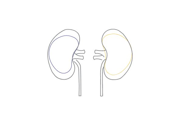 Nephrology