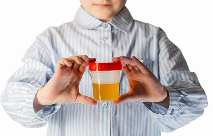 Recurrent urine infections in children Hyderabad Recurrent urine infections in children Hyderabad