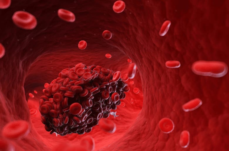 website blog image front (5) Blood Disorders