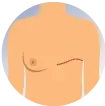 Disease
