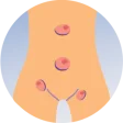 Disease