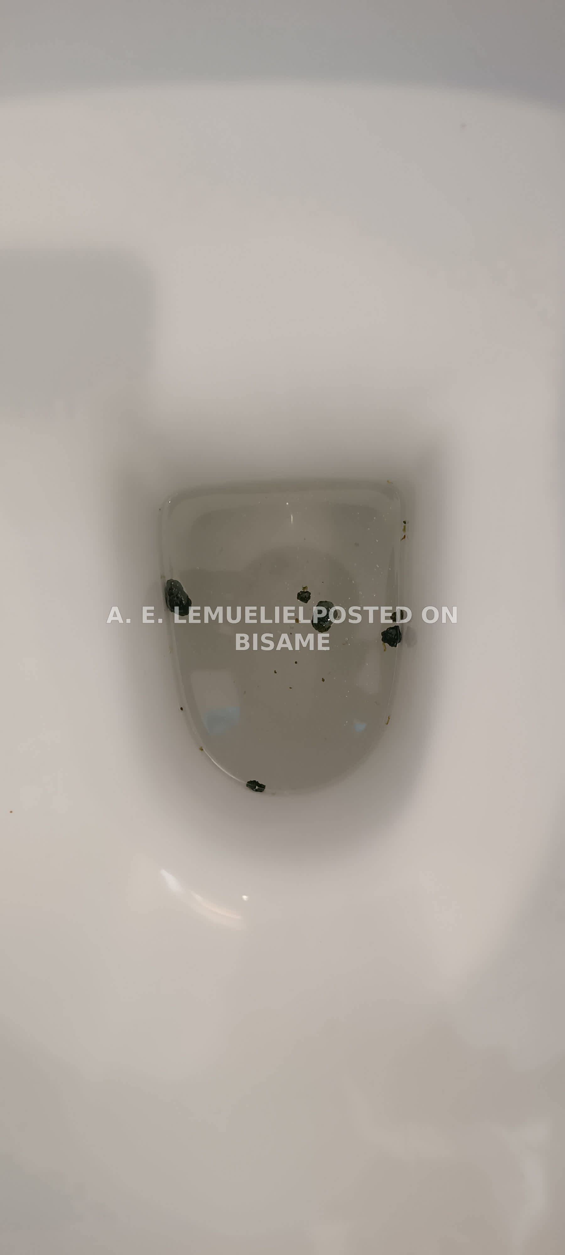 LIVER GALL BLADDER FLUSH SERVICE