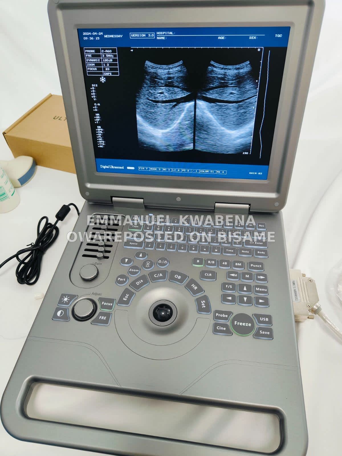 Ultrasound Scanner