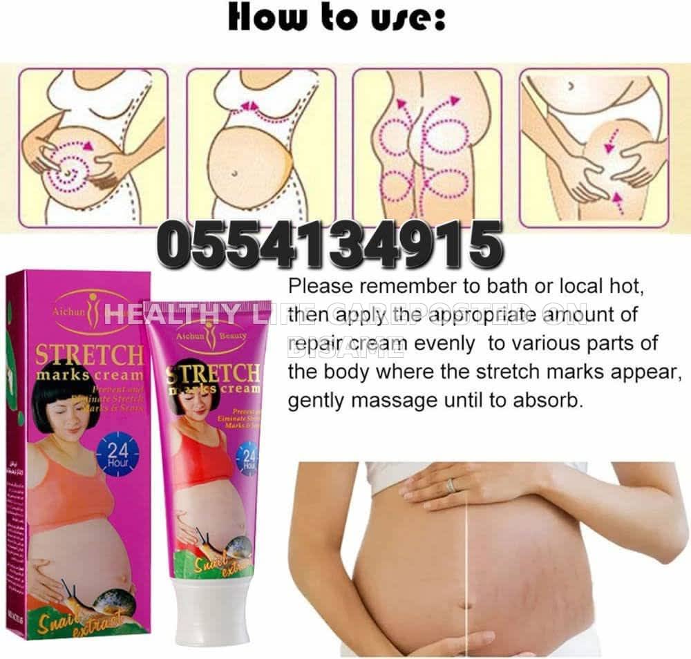 Aichun Beauty Stretch Marks Cream 