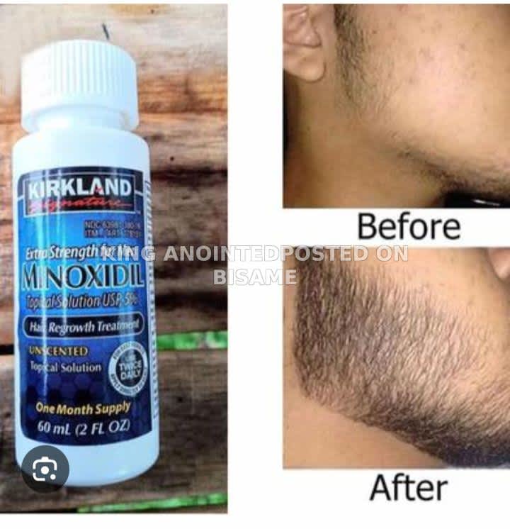 Kirkland Signature Minoxidil Hair Growth Oil 