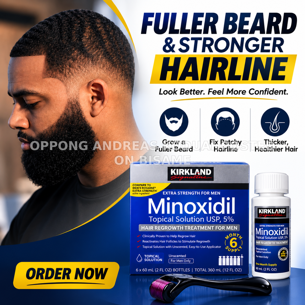 Kirkland Minoxidil 5% + Derma Roller