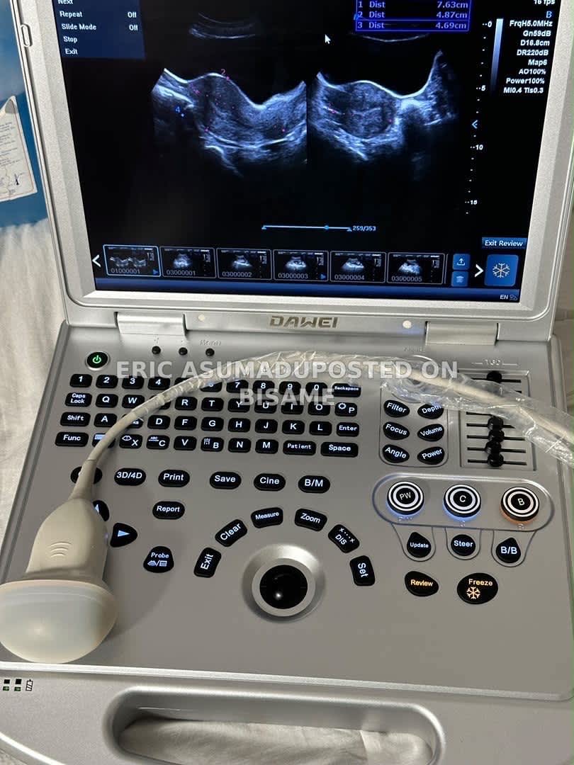 Dawei DW-L50 Portable Color Doppler Ultrasound Machine