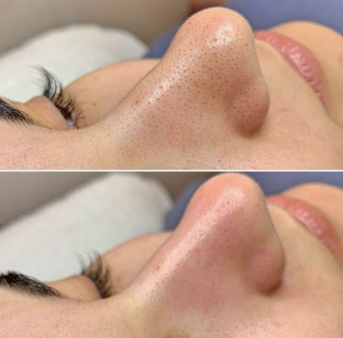Estrutura Spa
