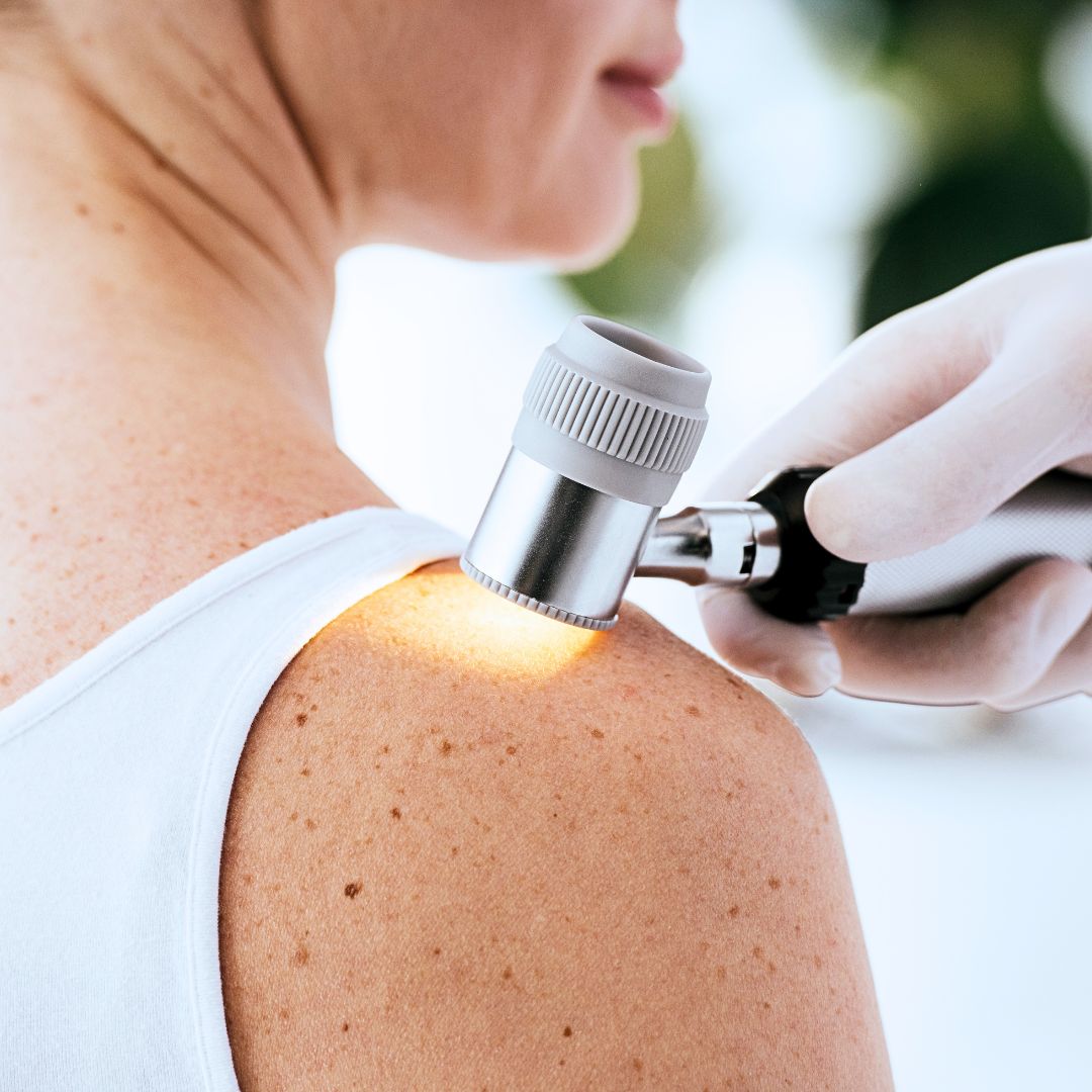Serviço de Dermatologia