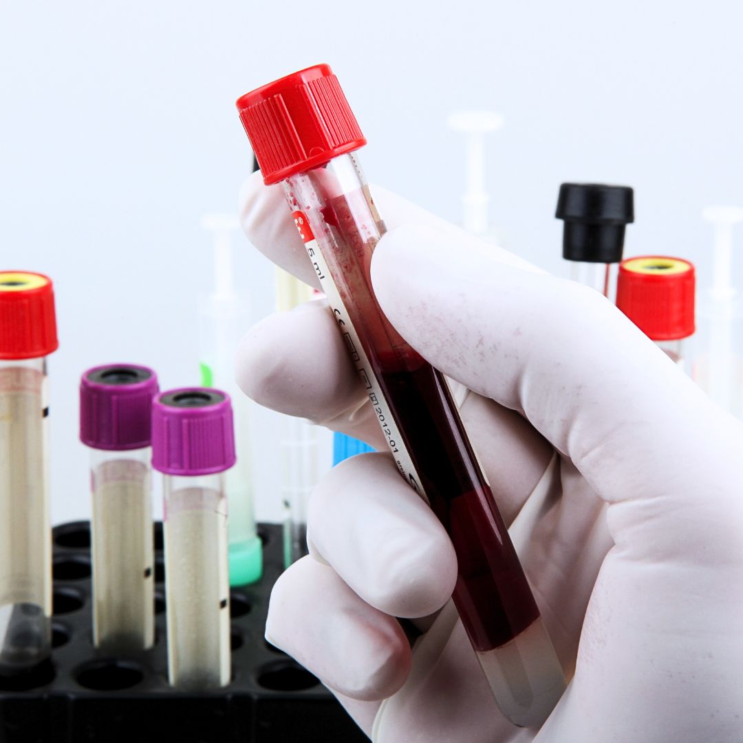 Serviço de Laboratório
