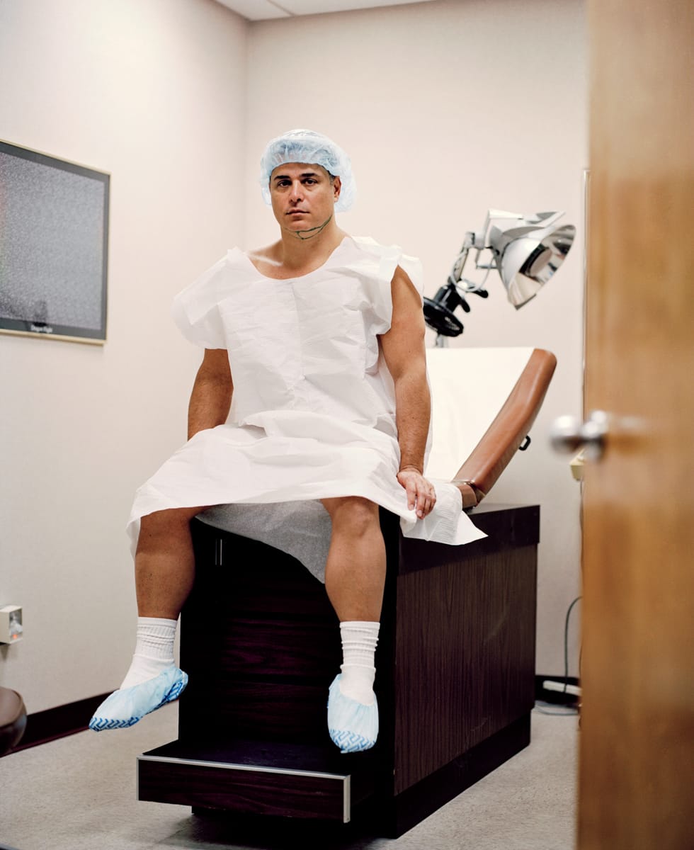 "I’m competing with men 20 years younger than me."
Anthony Mascolo, 46. Liposuction to chin and abdomen. New Jersey, USA.