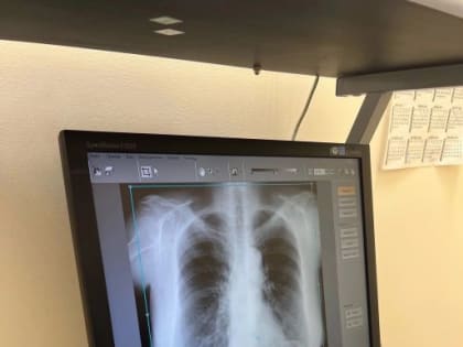 В магнитогорской горбольнице №2 ежегодно проводят около 20 тыс. исследований УЗИ