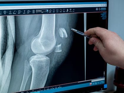 В Челябинске врачи обсудили восстановление пациентов после травм и операций
