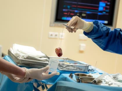 Спасли от инсульта: челябинские кардиохирурги удалили из сердца пенсионерки опухоль размером с абрикос