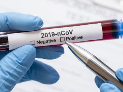 Коронавирус подтвержден у 103 южноуральцев за сутки