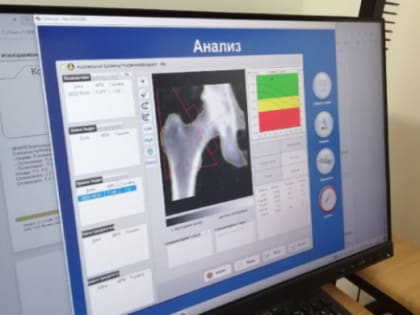 В ЧОКБ начал работу новый денситометр