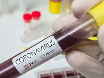 У 65 жителей Челябинской области выявили коронавирус за сутки