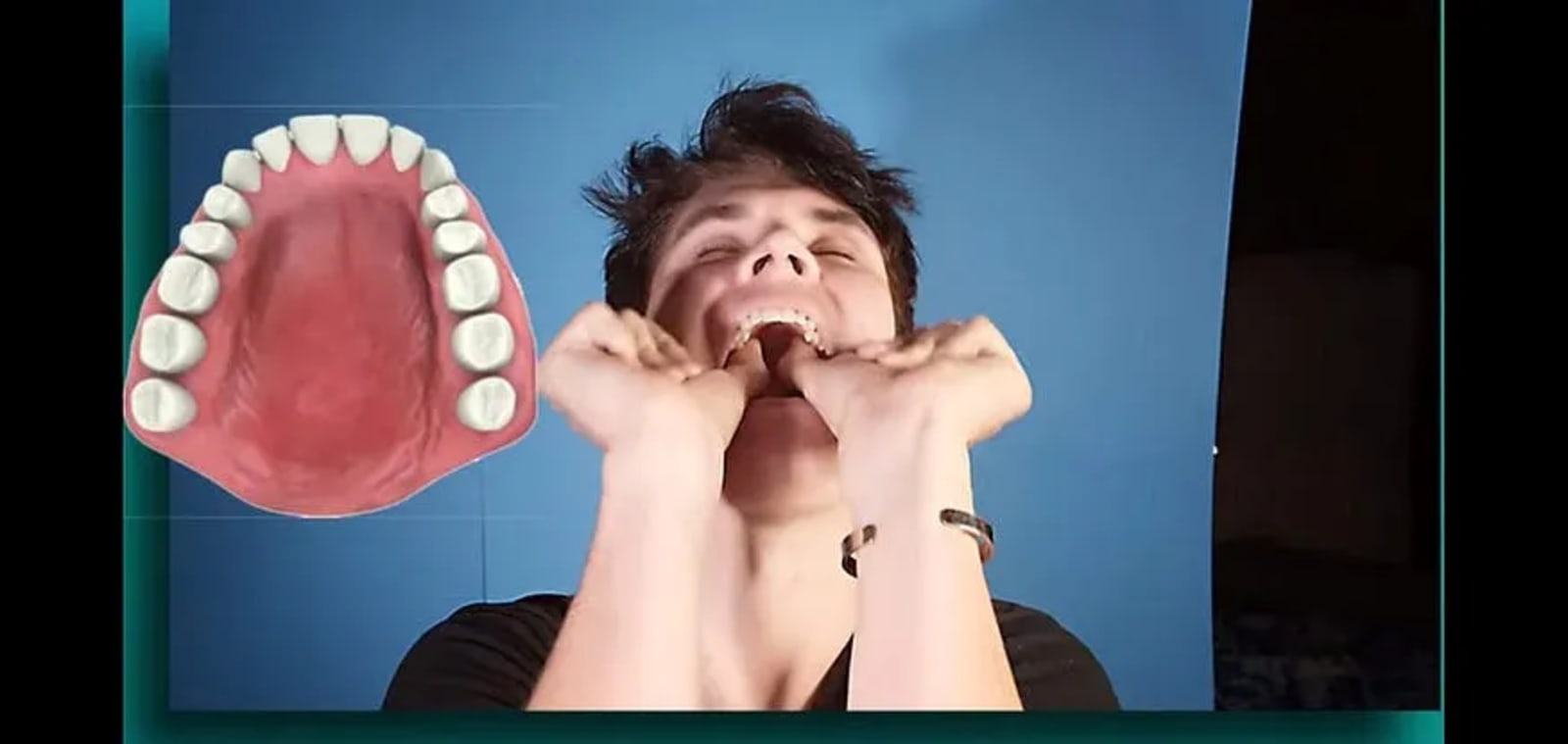 A young man attempts to expand his maxilla using the thumbpulling technique, with an image of a well-developed dental arch next to him