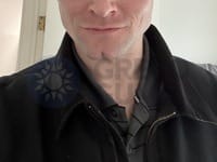 After image of a young man in side profile, showing larger masseter muscles