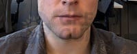 Before image of a young man in side profile