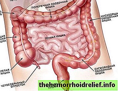 Схема оценки качества подготовки толстой кишки по бостонской шкале