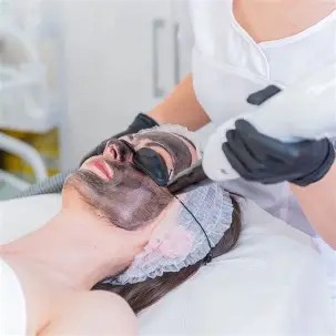 Carbon Peel