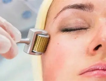 Derma Needling
