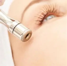 MDA (Microdermabrasion)