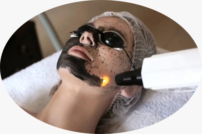 Derma Peel