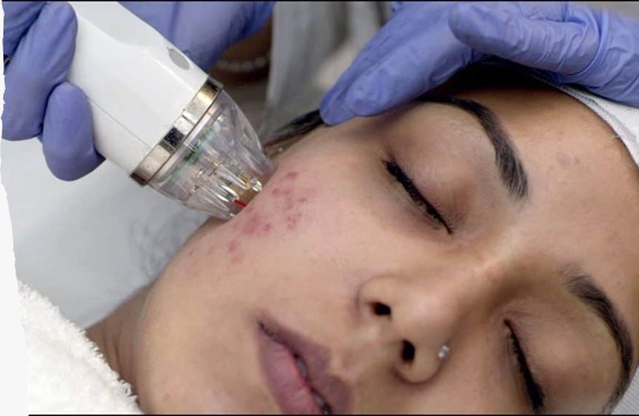 Skin Analysis & Client Consultation