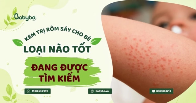 Kem trị rôm sảy cho bé loại nào tốt và lành tính được nhiều mẹ lựa chọn nhất hiện nay?