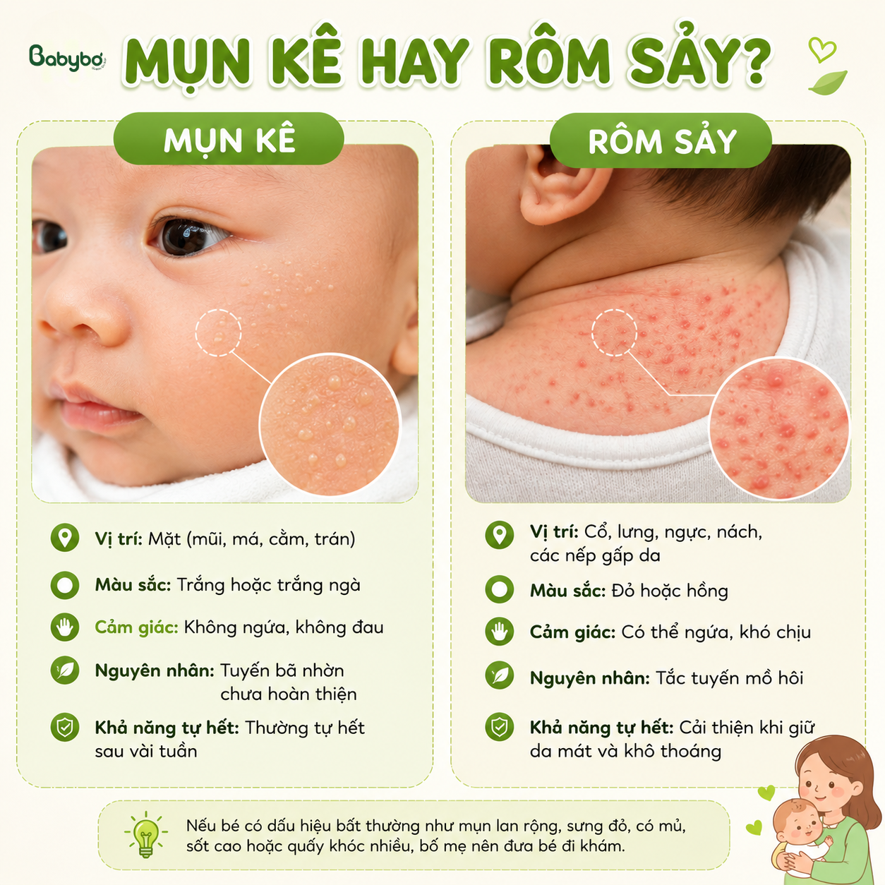 phân-biệt-mụn-kê-và- rôm-sảy- ở- trẻ -sơ- sinh