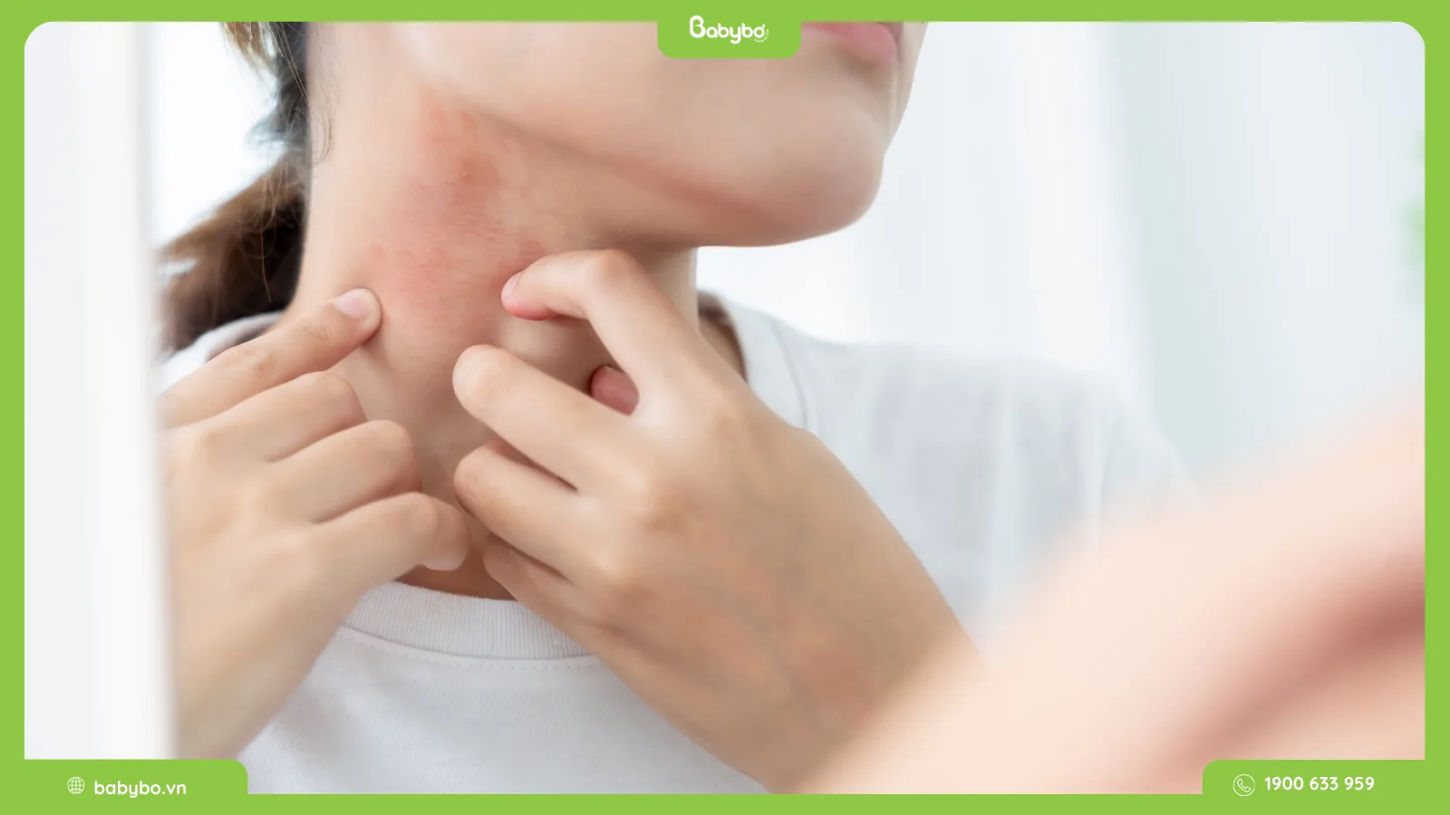 thuốc trị rôm sảy ở người lớn