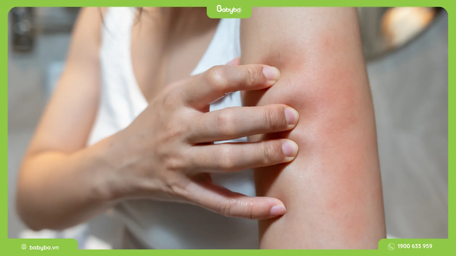 thuốc trị rôm sảy ở người lớn