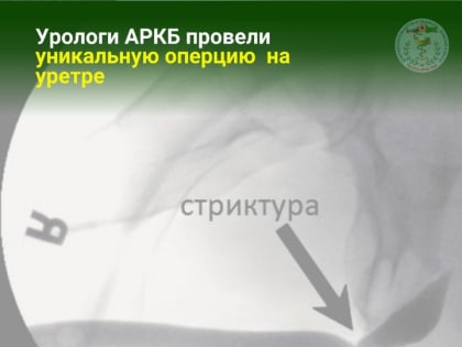 В Адыгее хирурги-урологи АРКБ провели уникальную операцию