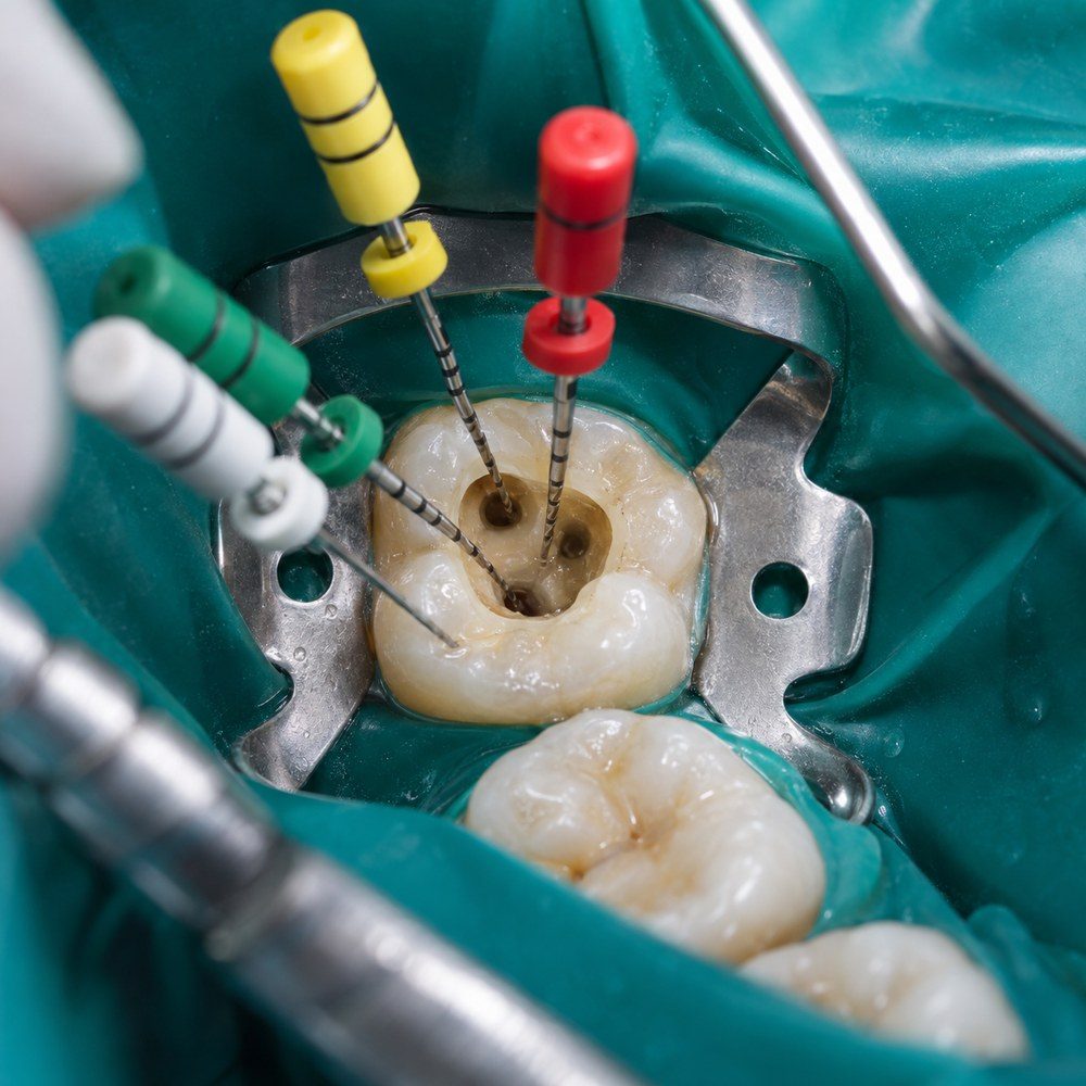 Endodoncia multirradicular