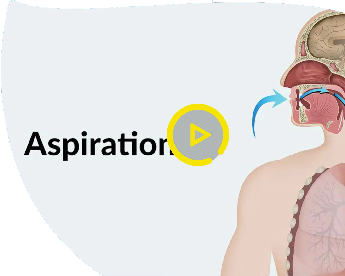 IDDSI How It Works Video
