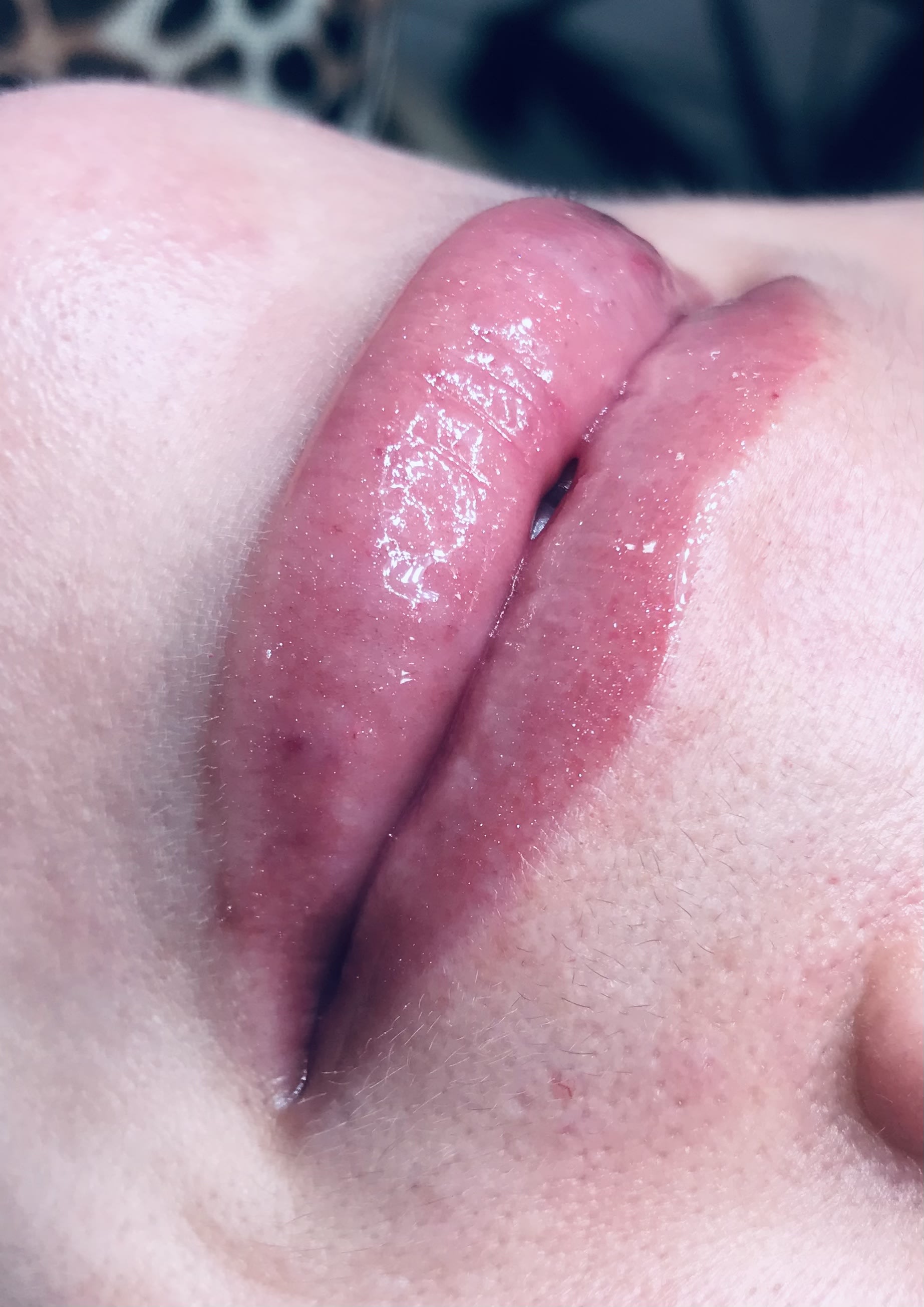 Hidra Gloss Lips