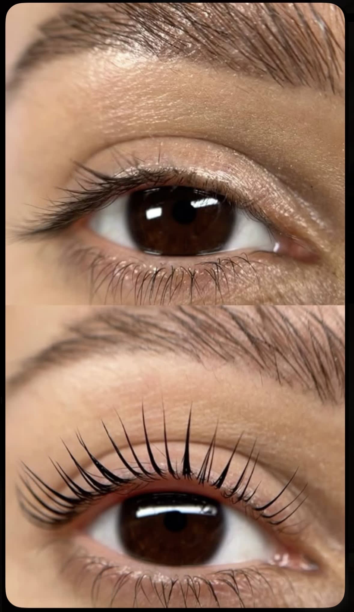 Lash lifting 