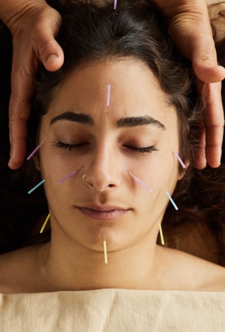 Facial Lifting Acupuntura