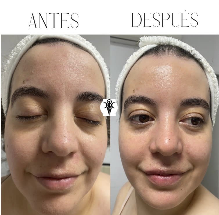 Facial Detox - Indicaciones