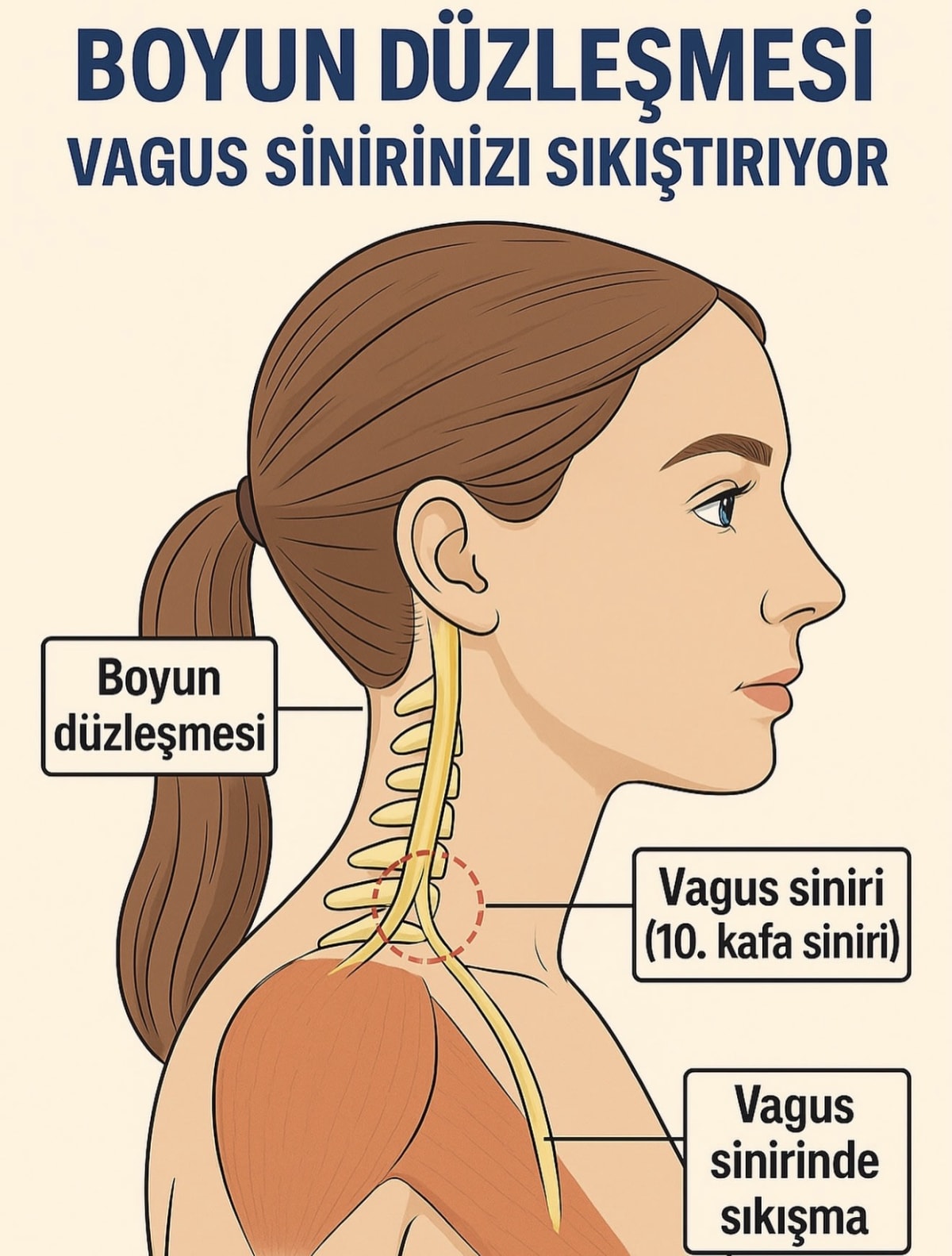 Boyun Düzleşmesi Nedir? Belirtileri ve Tedavisi