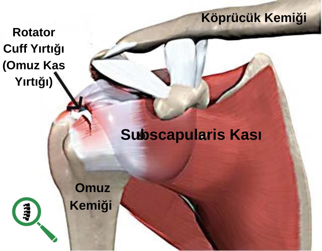 omuz yırtığı anatomisi