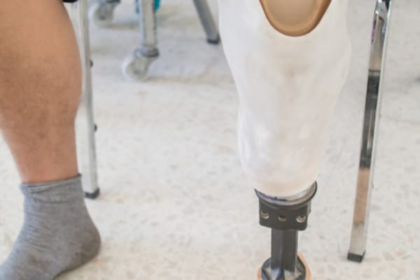 Protez Rehabilitasyonu